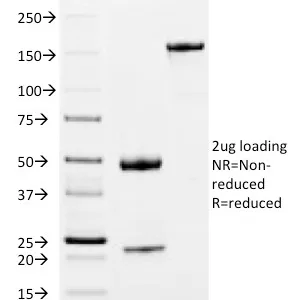 SDS-PAGE Analysis of Purified IgM Mouse Monoclonal Antibody (IM373). Confirmation of Integrity and Purity of Antibody.