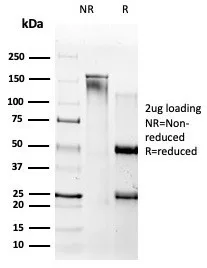 SDS-PAGE Analysis of Purified Beta Amyloid Mouse Monoclonal Antibody (APP/3667). Confirmation of Purity and Integrity of Antibody.