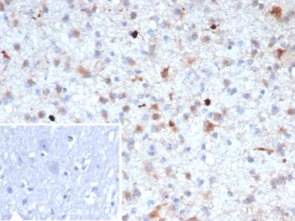 Formalin-fixed, paraffin-embedded human brain stained with Beta Amyloid Mouse Monoclonal Antibody (APP/3667). Inset: PBS instead of primary antibody; secondary only negative control.