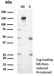 SDS-PAGE Analysis of Purified Lambda LC Recombinant Rabbit Monoclonal Antibody (IGL/9397R). Confirmation of Integrity and Purity of Antibody.