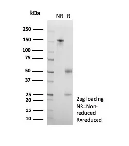 SDS-PAGE Analysis of Purified CD95 Recombinant Mouse Monoclonal Antibody (rB-R18). Confirmation of Purity and Integrity of Antibody.