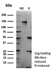 SDS-PAGE Analysis of Purified CD95 Recombinant Rabbit Monoclonal Antibody (FAS/9322R). Confirmation of Purity Integrity of Antibody.