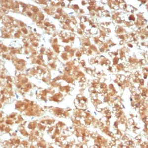 Formalin-fixed, paraffin-embedded human adrenal gland stained with Interleukin-1 Beta (IL-1B) Mouse Monoclonal Antibody (IL1B/4651). HIER: Tris/EDTA, pH9.0, 45min. 2°C: HRP-polymer, 30min. DAB, 5min.