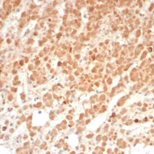 Formalin-fixed, paraffin-embedded human adrenal gland stained with Interleukin-1 Beta (IL-1B) Mouse Monoclonal Antibody (IL1B/4649). HIER: Tris/EDTA, pH9.0, 45min. 2°C: HRP-polymer, 30min. DAB, 5min.