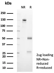 SDS-PAGE Analysis of Purified Interleukin-1RA Mouse Monoclonal Antibody (IL1RA/4712). Confirmation of Purity and Integrity of Antibody.