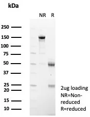 SDS-PAGE Analysis of Purified Interleukin-1RA Mouse Monoclonal Antibody (IL1RA/4715). Confirmation of Purity and Integrity of Antibody.