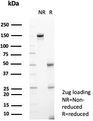 SDS-PAGE Analysis of Purified Interleukin-1RA Mouse Monoclonal Antibody (IL1RA/4716). Confirmation of Purity and Integrity of Antibody.