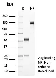 SDS-PAGE Analysis of Purified Interleukin-2 (IL-2) Mouse Monoclonal Antibody (IL2/8712). Confirmation of Purity and Integrity of Antibody.