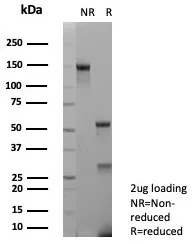 SDS-PAGE Analysis of Purified Interleukin-2 (IL-2) Mouse Monoclonal Antibody (IL2/9007). Confirmation of Purity and Integrity of Antibody.