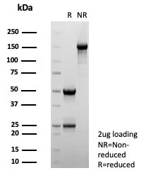 SDS-PAGE Analysis of Purified Interleukin-2 (IL-2) Mouse Monoclonal Antibody (IL2/4983). Confirmation of Purity and Integrity of Antibody.