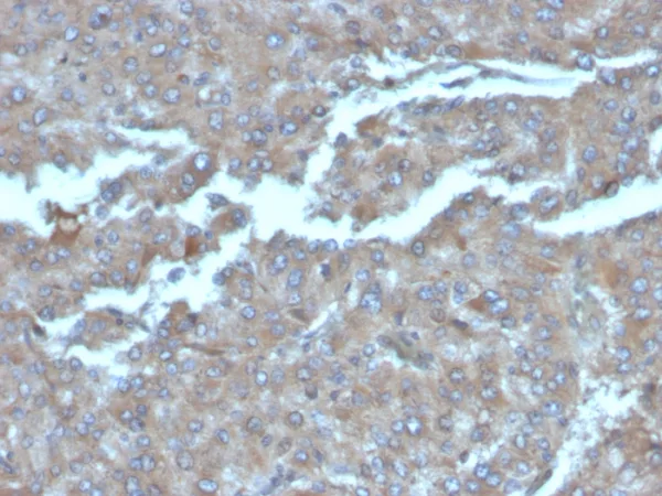 Formalin-fixed, paraffin-embedded human adrenal gland stained with Interleukin-2 (IL-2) Mouse Monoclonal Antibody (IL2/4983). HIER: Tris/EDTA, pH9.0, 45min. 2°C: HRP-polymer, 30min. DAB, 5min.