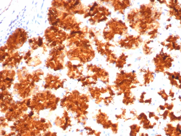 Formalin-fixed, paraffin-embedded human stomach stained with Interleukin-2 (IL-2) Mouse Monoclonal Antibody (IL2/4983). HIER: Tris/EDTA, pH9.0, 45min. 2°C: HRP-polymer, 30min. DAB, 5min.