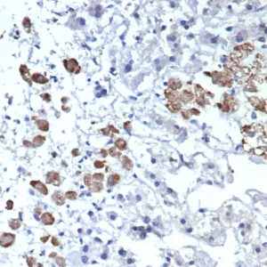 Formalin-fixed, paraffin-embedded human adrenal gland stained with Interleukin-2 (IL-2) Mouse Monoclonal Antibody (IL2/4984). HIER: Tris/EDTA, pH9.0, 45min. 2°C: HRP-polymer, 30min. DAB, 5min.