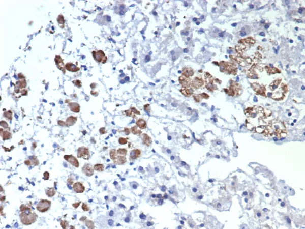 Formalin-fixed, paraffin-embedded human adrenal gland stained with Interleukin-2 (IL-2) Mouse Monoclonal Antibody (IL2/4984). HIER: Tris/EDTA, pH9.0, 45min. 2°C: HRP-polymer, 30min. DAB, 5min.