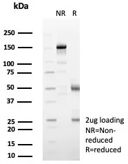SDS-PAGE Analysis of Purified Interleukin-2 (IL-2) Mouse Monoclonal Antibody (IL2/4985). Confirmation of Purity and Integrity of Antibody.