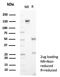 SDS-PAGE Analysis of Purified Interleukin-2 (IL-2) Mouse Monoclonal Antibody (IL2/4986). Confirmation of Purity and Integrity of Antibody.