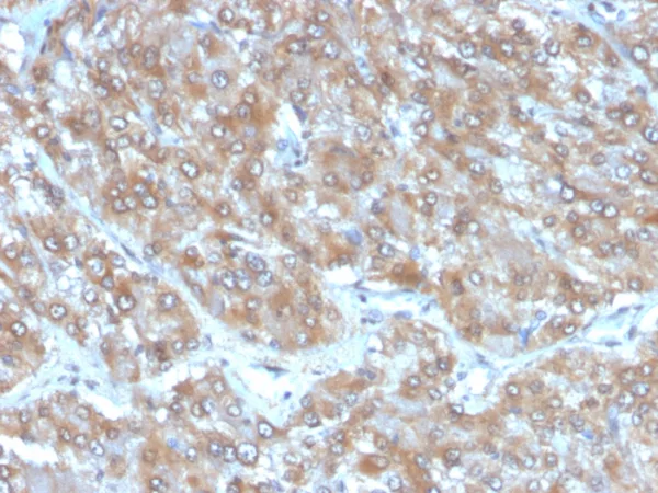 Formalin-fixed, paraffin-embedded human adrenal gland stained with Interleukin-2 (IL-2) Mouse Monoclonal Antibody (IL2/4988). HIER: Tris/EDTA, pH9.0, 45min. 2: HRP-polymer, 30min. DAB, 5min.