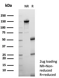 SDS-PAGE Analysis of Purified Interleukin-2 (IL-2) Mouse Monoclonal Antibody (IL2/7359). Confirmation of Purity and Integrity of Antibody.