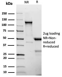 SDS-PAGE Analysis  Purified CD25 Recombinant Rabbit Monoclonal Antibody (IL2RA/4375R). Confirmation of Purity and Integrity of Antibody.