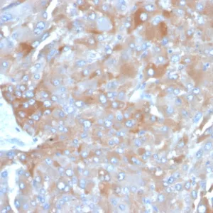 Formalin-fixed, paraffin-embedded human adrenal gland stained with Interleukin-3 (IL-3) Mouse Monoclonal Antibody (IL3/4003). HIER: Tris/EDTA, pH9.0, 45min. 2°C: HRP-polymer, 30min. DAB, 5min.