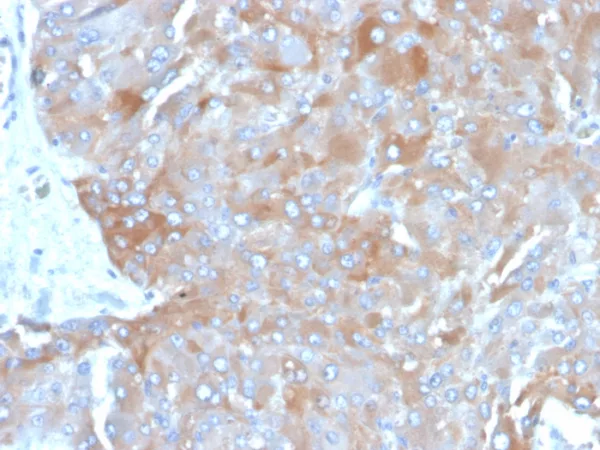 Formalin-fixed, paraffin-embedded human adrenal gland stained with Interleukin-3 (IL-3) Mouse Monoclonal Antibody (IL3/4003). HIER: Tris/EDTA, pH9.0, 45min. 2°C: HRP-polymer, 30min. DAB, 5min.