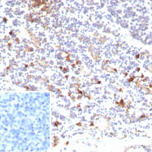 Formalin-fixed, paraffin-embedded human tonsil stained with IL3RA / CD123 Recombinant Mouse Monoclonal Antibody (rIL3RA/9212). Inset: PBS instead of primary antibody; secondary only negative control.