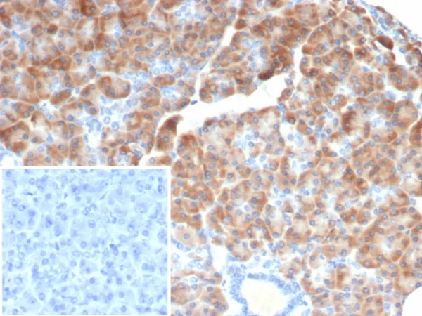 Formalin-fixed, paraffin-embedded human pancreas stained with IL-6 Mouse Monoclonal Antibody (IL6/4642) at 2ug/ml. Inset: PBS instead of primary antibody; secondary only negative control.