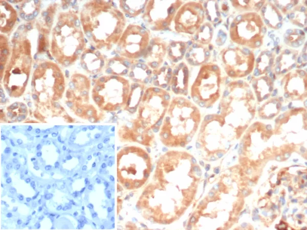 Formalin-fixed, paraffin-embedded human kidney stained with IL-6 Mouse Monoclonal Antibody (IL6/4643) at 2ug/ml. Inset: PBS instead of primary antibody; secondary only negative control.