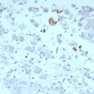 Formalin-fixed, paraffin-embedded human adrenal gland stained with IL-6 Mouse Monoclonal Antibody (IL6/8713). HIER: Tris/EDTA, pH9.0, 45min. 2°C: HRP-polymer, 30min. DAB, 5min.
