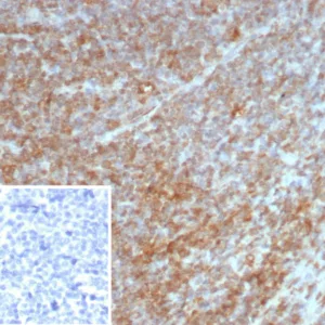 Formalin-fixed, paraffin-embedded human tonsil stained with Interleukin-7 (IL-7) Mouse Monoclonal Antibody (IL7/4269). Inset: PBS instead of primary antibody; secondary only negative control.