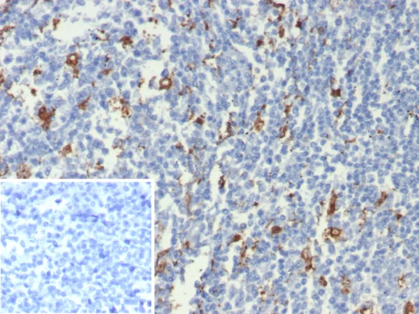 Formalin-fixed, paraffin-embedded human tonsil stained with IL-18 Mouse Monoclonal Antibody (IL18/7781) at 2ug/ml. Inset: PBS instead of primary antibody; secondary only negative control.