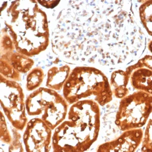 Formalin-fixed, paraffin-embedded human kidney stained with IL-6 Mouse Monoclonal Antibody (IL18/4622) at 2ug/ml. Inset: PBS instead of primary antibody; secondary only negative control.
