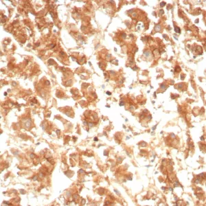 Formalin-fixed, paraffin-embedded human adrenal gland stained with IL-18 Mouse Monoclonal Antibody (IL18/4623). HIER: Tris/EDTA, pH9.0, 45min. 2°C: HRP-polymer, 30min. DAB, 5min.