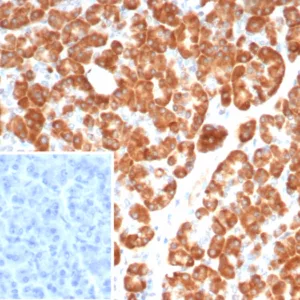 Formalin-fixed, paraffin-embedded human pancreas stained with IL-6 Mouse Monoclonal Antibody (IL18/4624) at 2ug/ml. Inset: PBS instead of primary antibody; secondary only negative control.