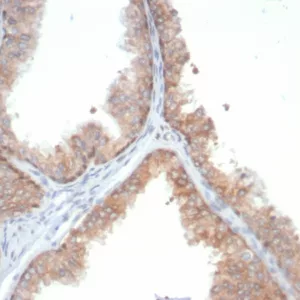 Formalin-fixed, paraffin-embedded human prostate stained with IL-18 Mouse Monoclonal Antibody (IL18/4628) at 2ug/ml. HIER: Tris/EDTA, pH9.0, 45min. 2°C: HRP-polymer, 30min. DAB, 5min.