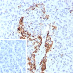 Formalin-fixed, paraffin-embedded human pancreas stained with Insulin Recombinant Mouse Monoclonal Antibody (rIRDN/8546). Inset: PBS instead of primary antibody; secondary only negative control.