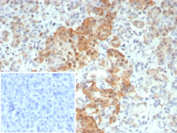 Formalin-fixed, paraffin-embedded human pancreas stained with INSM-1 Recombinant Rabbit Monoclonal Antibody (INSM1/8122R). HIER: Tris/EDTA, pH9.0, 45min. 2: HRP-polymer, 30min. DAB, 5min.