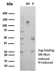 SDS-PAGE Analysis of Purified IRF3 Mouse Monoclonal Antibody (PCRP-IRF3-2F9). Confirmation of Purity and Integrity of Antibody.
