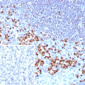 Formalin-fixed, paraffin-embedded human tonsil stained with MUM1 Rabbit Monoclonal Antibody (MUM1/8560R). Inset: PBS instead of primary antibody; secondary only negative control.