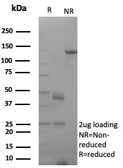 SDS-PAGE Analysis of Purified AR Recombinant Mouse Monoclonal Antibody (rDHTR/8818).  Confirmation of Purity and Integrity of Antibody.