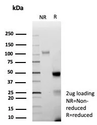 SDS-PAGE Analysis of Purified AR Recombinant Rabbit Monoclonal Antibody (DHTR/9119R).  Confirmation of Purity and Integrity of Antibody.