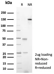 SDS-PAGE Analysis of Purified AR Recombinant Rabbit Monoclonal Antibody (DHTR/4929R).  Confirmation of Purity and Integrity of Antibody.