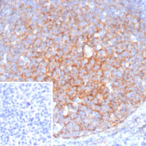 Formalin-fixed, paraffin-embedded human tonsil stained with CD11b Mouse Monoclonal Antibody (ITGAM/4741). Inset: PBS instead of primary antibody; secondary only negative control.
