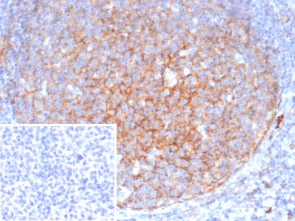 Formalin-fixed, paraffin-embedded human tonsil stained with CD11b Mouse Monoclonal Antibody (ITGAM/4741). Inset: PBS instead of primary antibody; secondary only negative control.