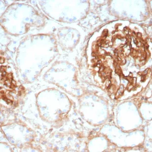 Formalin-fixed, paraffin-embedded human kidney stained with CD29 Recombinant Rabbit Monoclonal Antibody (ITGB1/8744R). HIER: Tris/EDTA, pH9.0, 45min. 2°C: HRP-polymer, 30min. DAB, 5min.