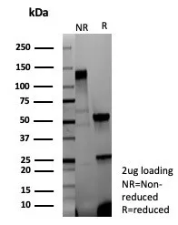 SDS-PAGE Analysis of Purified Involucrin Mouse Recombinant Monoclonal Antibody (rIVRN/9323). Confirmation of Purity and Integrity of Antibody.