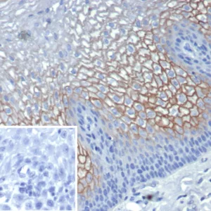 Formalin-fixed, paraffin-embedded human esophagus stained with Suprabasin (SBSN) Mouse Monoclonal Antibody (SBSN/7961). HIER: Tris/EDTA, pH9.0, 45min. 2°C: HRP-polymer, 30min. DAB, 5min.