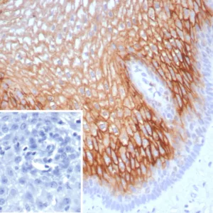 Formalin-fixed, paraffin-embedded human esophagus stained with Suprabasin (SBSN) Mouse Monoclonal Antibody (SBSN/7963). Inset: PBS instead of primary antibody; secondary only negative control.