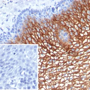 Formalin-fixed, paraffin-embedded human esophagus stained with Suprabasin (SBSN) Mouse Monoclonal Antibody (SBSN/7964). Inset: PBS instead of primary antibody; secondary only negative control.