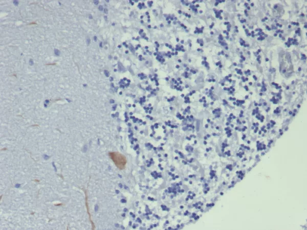 Formalin-fixed, paraffin-embedded human brain stained with GIRK2 Mouse Monoclonal Antibody (KCNJ6/7559) at 2ug/ml. HIER: Tris/EDTA, pH9.0, 45min. 2°C: HRP-polymer, 30min. DAB, 5min.